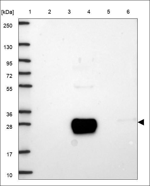 Lane 1: Marker [kDa] 250,130,95,72,55,36,28,17,10 Lane 2: RT4 Lane 3: U-251 MG Lane 4: Human Plasma Lane 5: Liver Lane 6: Tonsil