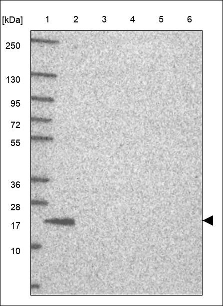 Lane 1: Marker [kDa] 250,130,95,72,55,36,28,17,10 Lane 2: RT4 Lane 3: U-251 MG Lane 4: Human Plasma Lane 5: Liver Lane 6: Tonsil