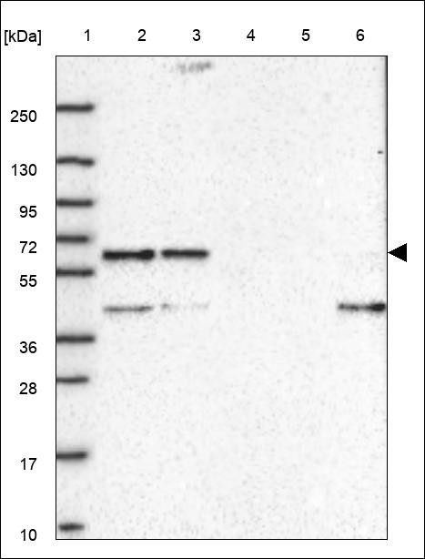 Lane 1: Marker [kDa] 250,130,95,72,55,36,28,17,10 Lane 2: RT4 Lane 3: U-251 MG Lane 4: Human Plasma Lane 5: Liver Lane 6: Tonsil
