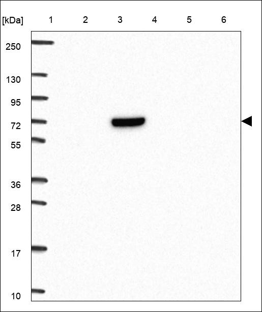 Lane 1: Marker [kDa] 250,130,95,72,55,36,28,17,10 Lane 2: RT4 Lane 3: U-251 MG Lane 4: Human Plasma Lane 5: Liver Lane 6: Tonsil