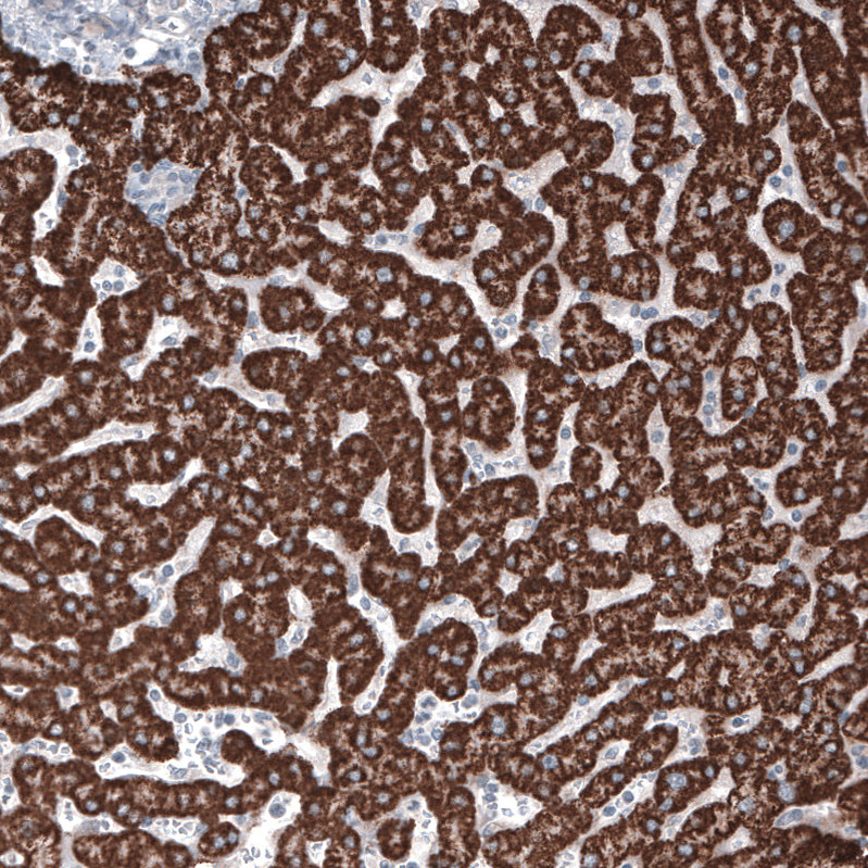Immunohistochemical staining of human liver shows strong granular cytoplasmic positivity in hepatocytes.