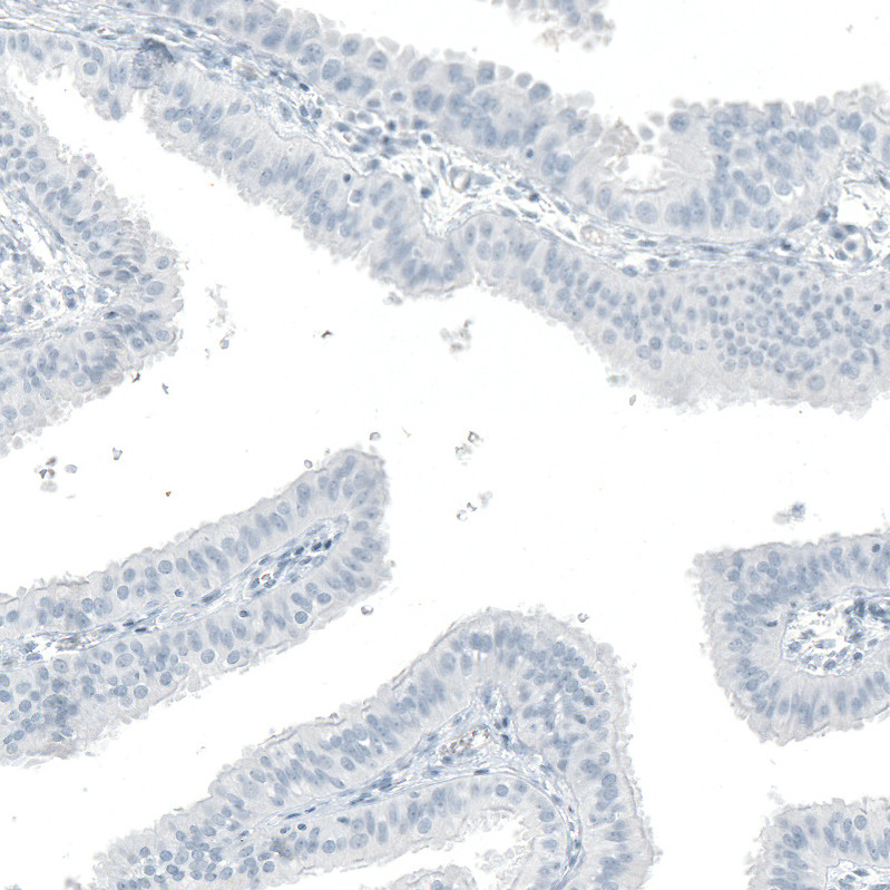 Immunohistochemical staining of human fallopian tube shows no positivity in glandular cells as expected.