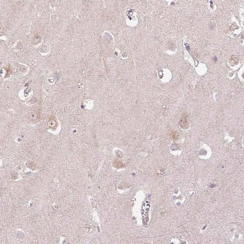 Immunohistochemical staining of human cerebral cortex shows weak cytoplasmic positivity in neurons.