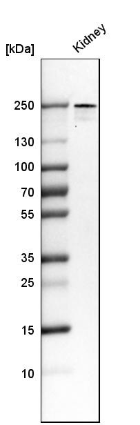Western blot analysis in human kidney tissue.