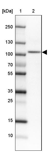 Lane 1: Marker [kDa]<br/>Lane 2: Human cell line HEL