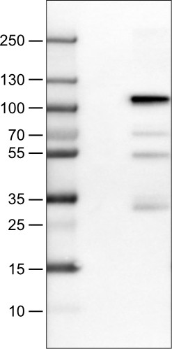 Lane 1: Marker [kDa]<br/>Lane 2: Negative control (vector only transfected HEK293T lysate) <br/>Lane 3: SATB2 Over-expression Lysate (Co-expressed with a C-terminal myc-DDK tag (~3.1 kDa) in mammalian HEK293T cells, LY414656)