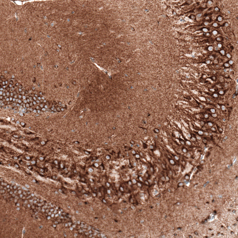 Immunohistochemical staining of mouse hippocampus shows strong cytoplasmic positivity in both pyramidal neurons and granular cells.