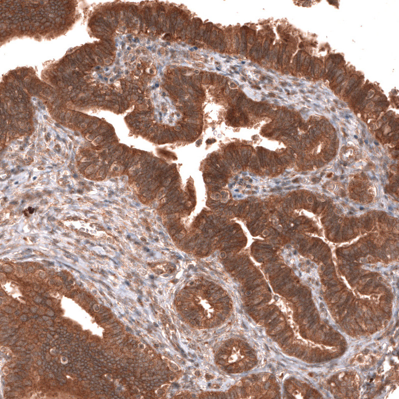 Immunohistochemical staining of human fallopian tube shows strong cytoplasmic positivity in glandular cells.