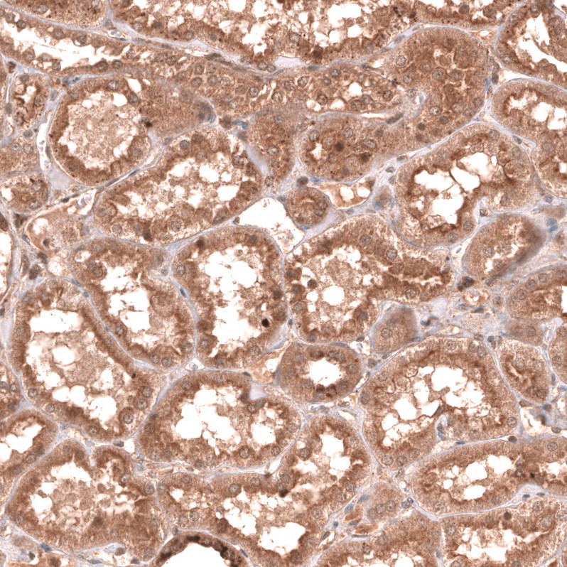 Immunohistochemical staining of human kidney shows moderate cytoplasmic positivity in cells in tubules.