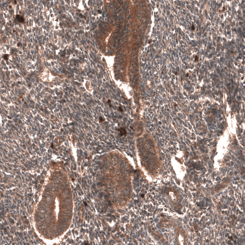 Immunohistochemical staining of human endometrium shows strong cytoplasmic positivity in glandular cells.