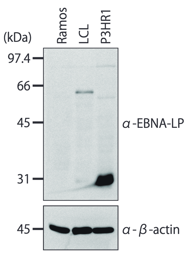 Western blot analysis of EBNA-LP in Ramos, LCL and P3HR1 cell lysate with anti- EBNA-LP antibody (LP4D3, 1μg/mL).
