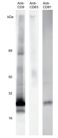 Representative Western Blot analysis using CD9, CD63 or CD81 monoclonal antibody.Using 0.5 ug of protein as a sample, each protein was detected by western blot using Anti-CD9 monoclonal antibody (Cat. No. CSR-SHI-EXO-M01), AntiCD63 monoclonal antibody (Cat. No. CRS-SHI-EXO-M02), and Anti-CD81 monoclonal antibody (Cat. No. CSR-SHIEXO-M03).
