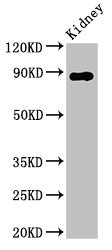 Western Blot
Positive WB detected in: Rat kidney tissue
All lanes: DPP4 antibody at 2.8μg/ml
Secondary
Goat polyclonal to rabbit IgG at 1/50000 dilution
Predicted band size: 89 kDa
Observed band size: 89 kDa