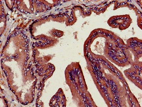 Immunohistochemistry of paraffin-embedded human prostate tissue using CSB-PA06229A0Rb at dilution of 1:100