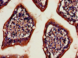Immunohistochemistry of paraffin-embedded human small intestine tissue using CSB-PA06229A0Rb at dilution of 1:100