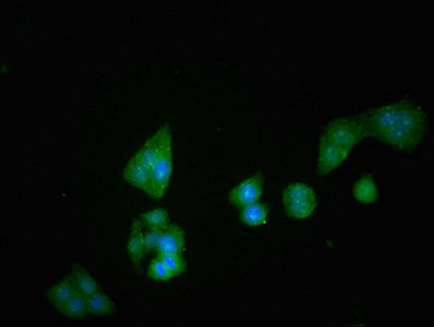 Immunofluorescent analysis of PC-3 cells using CSB-PA06229A0Rb at dilution of 1:100 and Alexa Fluor 488-congugated AffiniPure Goat Anti-Rabbit IgG(H+L)