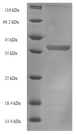 (Tris-Glycine gel) Discontinuous SDS-PAGE (reduced) with 5% enrichment gel and 15% separation gel.