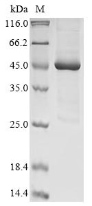 (Tris-Glycine gel) Discontinuous SDS-PAGE (reduced) with 5% enrichment gel and 15% separation gel.