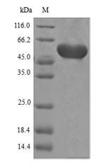 (Tris-Glycine gel) Discontinuous SDS-PAGE (reduced) with 5% enrichment gel and 15% separation gel.
