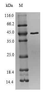 (Tris-Glycine gel) Discontinuous SDS-PAGE (reduced) with 5% enrichment gel and 15% separation gel.