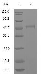 (Tris-Glycine gel) Discontinuous SDS-PAGE (reduced) with 5% enrichment gel and 15% separation gel.
