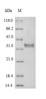 (Tris-Glycine gel) Discontinuous SDS-PAGE (reduced) with 5% enrichment gel and 15% separation gel.
