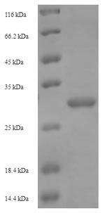 (Tris-Glycine gel) Discontinuous SDS-PAGE (reduced) with 5% enrichment gel and 15% separation gel.