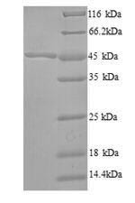 (Tris-Glycine gel) Discontinuous SDS-PAGE (reduced) with 5% enrichment gel and 15% separation gel.