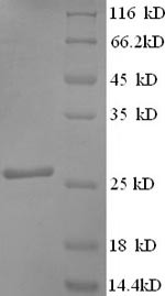 (Tris-Glycine gel) Discontinuous SDS-PAGE (reduced) with 5% enrichment gel and 15% separation gel.