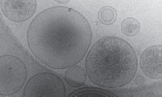 Exosomes & Extracellular Vesicles