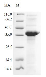 (Tris-Glycine gel) Discontinuous SDS-PAGE (reduced) with 5% enrichment gel and 15% separation gel.
