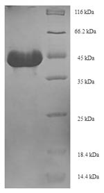 (Tris-Glycine gel) Discontinuous SDS-PAGE (reduced) with 5% enrichment gel and 15% separation gel.