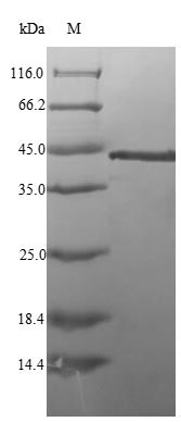 (Tris-Glycine gel) Discontinuous SDS-PAGE (reduced) with 5% enrichment gel and 15% separation gel.