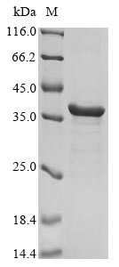 (Tris-Glycine gel) Discontinuous SDS-PAGE (reduced) with 5% enrichment gel and 15% separation gel.