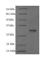 (Tris-Glycine gel) Discontinuous SDS-PAGE (reduced) with 5% enrichment gel and 15% separation gel.