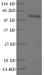 (Tris-Glycine gel) Discontinuous SDS-PAGE (reduced) with 5% enrichment gel and 15% separation gel.