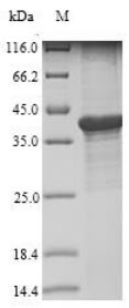 (Tris-Glycine gel) Discontinuous SDS-PAGE (reduced) with 5% enrichment gel and 15% separation gel.