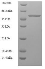 (Tris-Glycine gel) Discontinuous SDS-PAGE (reduced) with 5% enrichment gel and 15% separation gel.