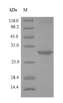 (Tris-Glycine gel) Discontinuous SDS-PAGE (reduced) with 5% enrichment gel and 15% separation gel.