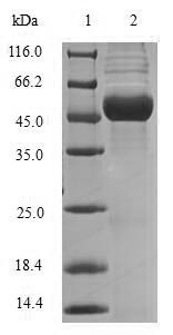 (Tris-Glycine gel) Discontinuous SDS-PAGE (reduced) with 5% enrichment gel and 15% separation gel.