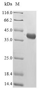 (Tris-Glycine gel) Discontinuous SDS-PAGE (reduced) with 5% enrichment gel and 15% separation gel.