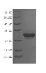 (Tris-Glycine gel) Discontinuous SDS-PAGE (reduced) with 5% enrichment gel and 15% separation gel.