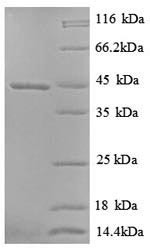 (Tris-Glycine gel) Discontinuous SDS-PAGE (reduced) with 5% enrichment gel and 15% separation gel.