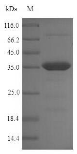 (Tris-Glycine gel) Discontinuous SDS-PAGE (reduced) with 5% enrichment gel and 15% separation gel.