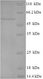 (Tris-Glycine gel) Discontinuous SDS-PAGE (reduced) with 5% enrichment gel and 15% separation gel.
