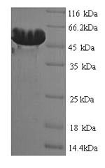 (Tris-Glycine gel) Discontinuous SDS-PAGE (reduced) with 5% enrichment gel and 15% separation gel.
