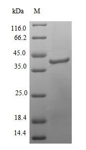 (Tris-Glycine gel) Discontinuous SDS-PAGE (reduced) with 5% enrichment gel and 15% separation gel.