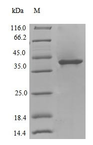 (Tris-Glycine gel) Discontinuous SDS-PAGE (reduced) with 5% enrichment gel and 15% separation gel.