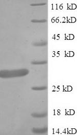 (Tris-Glycine gel) Discontinuous SDS-PAGE (reduced) with 5% enrichment gel and 15% separation gel.