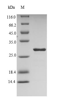 (Tris-Glycine gel) Discontinuous SDS-PAGE (reduced) with 5% enrichment gel and 15% separation gel.